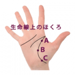 1.手相の生命線上にあるほくろ占い